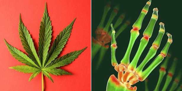 Cannabis Strains For Chronic Pain