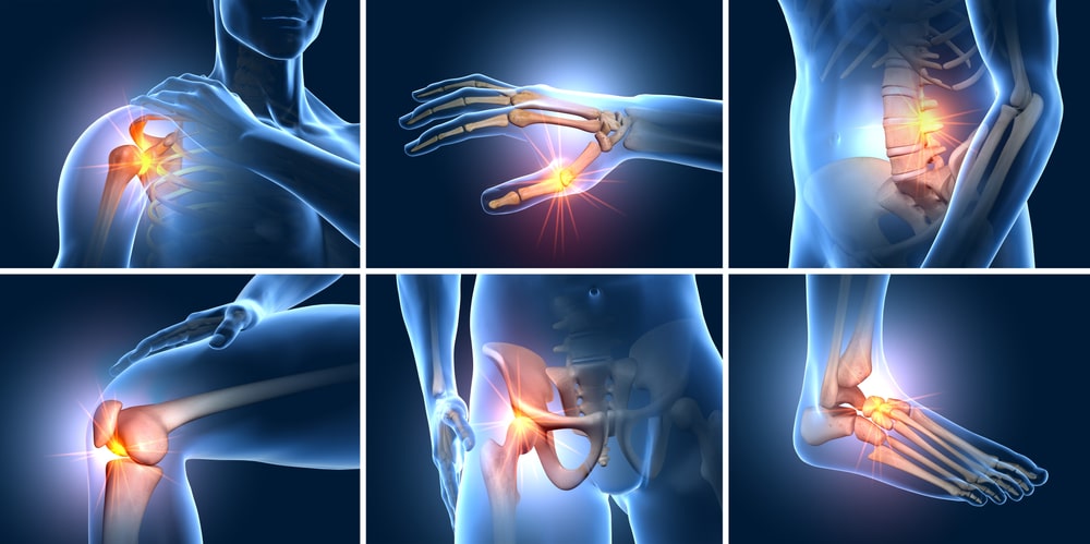 Chronic Joint Pain image